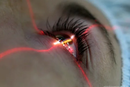 Клиника микрохирургии глаза Клиника микрохирургии глаза фото 5