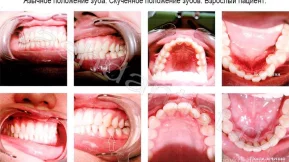 Стоматологическая клиника Наш дантист на Павшинском бульваре фото 2