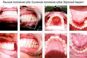 Стоматологическая клиника Наш дантист на Павшинском бульваре фото 2